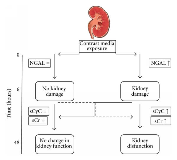 CysC與NGAL、Cr的關(guān)系