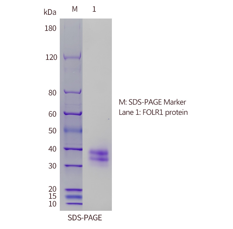 FBP SDS-PAGE FBP SDS-PAGE